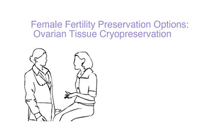 Female Fertility Preservation Options: Ovarian Tissue Cryopreservation